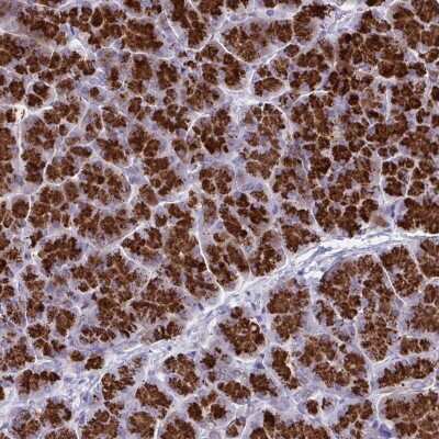 Immunohistochemistry-Paraffin: TANK Antibody [NBP2-38357]