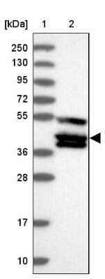 Western Blot: TANK Antibody [NBP2-38358]