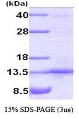 SDS-PAGE: Recombinant Human TANK Protein [NBC1-22948]