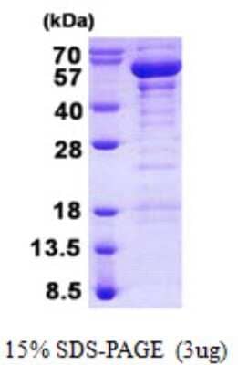 SDS-PAGE: Recombinant Human TANK His Protein [NBP2-22874]