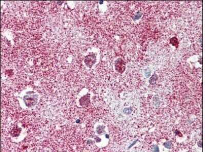 Immunohistochemistry-Paraffin: TAO Kinase 1 Antibody - BSA Free [NBP1-50166]