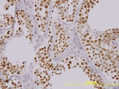 Immunohistochemistry-Paraffin: TAO Kinase 1 Antibody (4E12) [H00057551-M01]