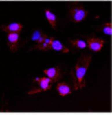 Immunocytochemistry/ Immunofluorescence: TAO Kinase 1 Antibody [NBP1-89864]