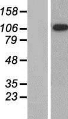 Western Blot: TAO Kinase 1 Overexpression Lysate [NBP2-06605]