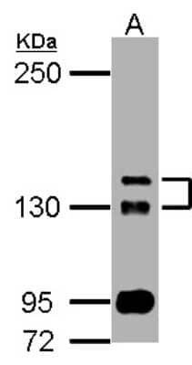 Western Blot: TAO2 Antibody [NBP2-20563]