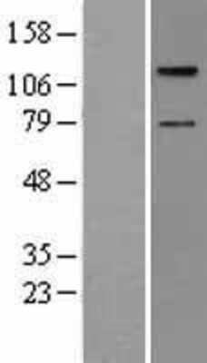 Western Blot: TAO2 Overexpression Lysate [NBL1-16697]