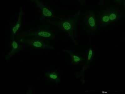 Immunocytochemistry/ Immunofluorescence: TAO2 Antibody (2F4) [H00009344-M11]