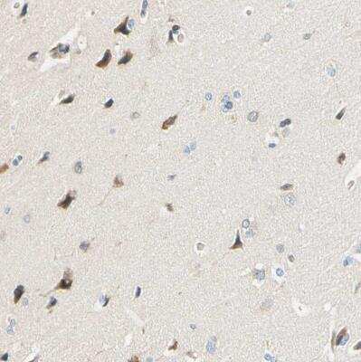 Immunohistochemistry-Paraffin: TAO2 Antibody [NBP1-81465]