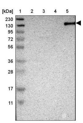 Western Blot: TAO2 Antibody [NBP1-81465]