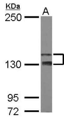 Western Blot: TAO2 Antibody [NBP2-20562]