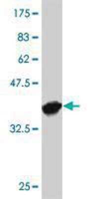 Western Blot: TAO2 Antibody (2H6) [H00009344-M08]