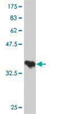 Western Blot: TAO2 Antibody (3A12) [H00009344-M04]