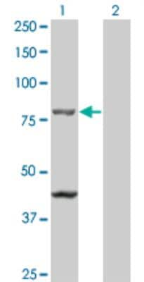 Western Blot: TAP1 Antibody (2B4) [H00006890-M01]