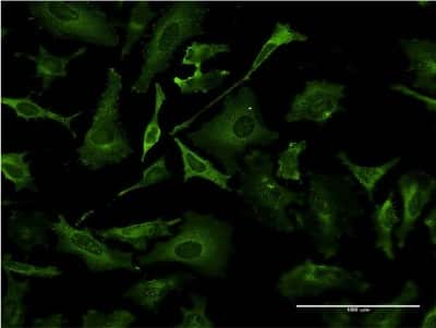 Immunocytochemistry/ Immunofluorescence: TAP1 Antibody (3D4) [H00006890-M04]