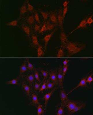 Immunocytochemistry/ Immunofluorescence: TAP2 Antibody - Azide and BSA Free [NBP2-93797]