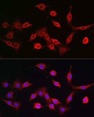 Immunocytochemistry/ Immunofluorescence: TAP2 Antibody - Azide and BSA Free [NBP2-93797]