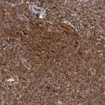 Immunohistochemistry-Paraffin: TAP2 Antibody [NBP1-89312]