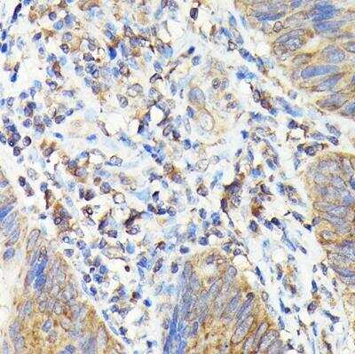 Immunohistochemistry-Paraffin: TAP2 Antibody - Azide and BSA Free [NBP2-93797]