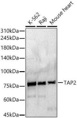 Western Blot: TAP2 AntibodyAzide and BSA Free [NBP2-93797]