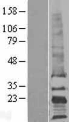 Western Blot: CD81 Overexpression Lysate [NBL1-08973]