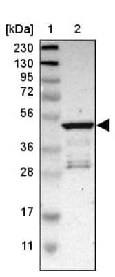 Western Blot: TAPP1/PLEKHA1 Antibody [NBP1-86967]