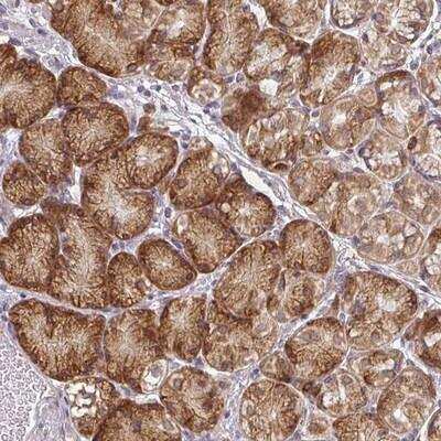 Immunohistochemistry: TAPT1 Antibody [NBP2-14522]