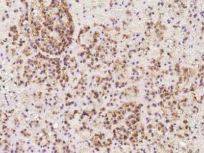 Immunohistochemistry-Paraffin: TAPT1 Antibody [NBP2-98498]
