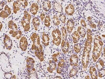 Immunohistochemistry-Paraffin: TAPT1 Antibody [NBP2-98498]