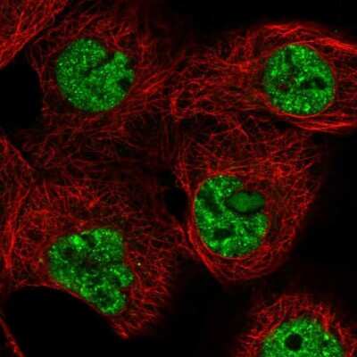 Immunocytochemistry/ Immunofluorescence: TARBP1 Antibody [NBP1-86902]