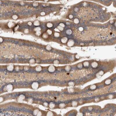 Immunohistochemistry-Paraffin: TARBP1 Antibody [NBP1-86902]