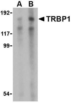 Western Blot: TARBP1 AntibodyBSA Free [NBP1-76400]