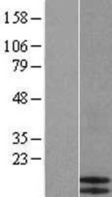 Western Blot: CCL17/TARC Overexpression Lysate [NBP2-10863]