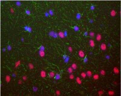 Immunocytochemistry/ Immunofluorescence: TDP-43/TARDBP Antibody (3H8) [NBP1-92695]