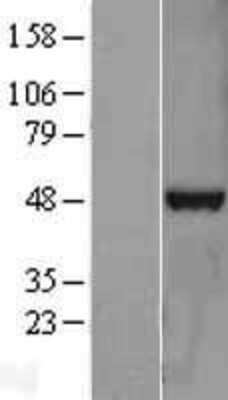 Western Blot: TDP-43/TARDBP Overexpression Lysate [NBL1-16701]