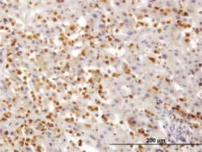 Immunohistochemistry-Paraffin: TARS Antibody (1A9) [H00006897-M01]