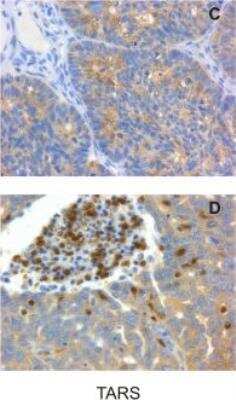 Immunohistochemistry-Paraffin: TARS Antibody (1A9) [H00006897-M01]