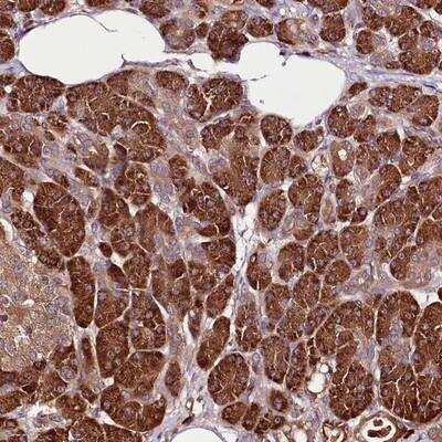 Immunohistochemistry-Paraffin: TARS Antibody [NBP1-89427]