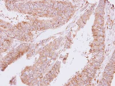 Immunohistochemistry-Paraffin: TARS Antibody [NBP2-20566]