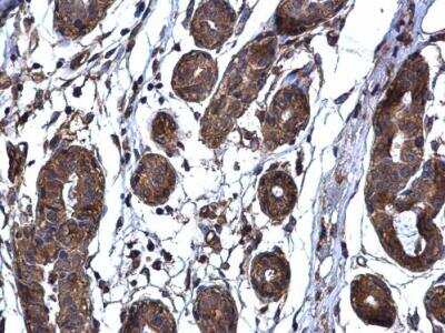 Immunohistochemistry-Paraffin: TARS Antibody [NBP2-20567]