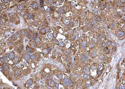 Immunohistochemistry-Paraffin: TARS Antibody [NBP2-20567]