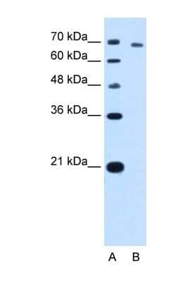 Western Blot: TARS Antibody [NBP1-55369]