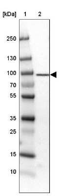 Western Blot: TARS Antibody [NBP1-89427]