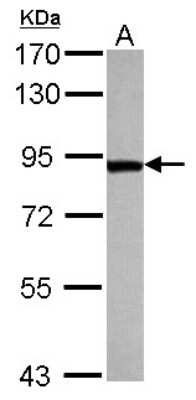 Western Blot: TARS Antibody [NBP2-20566]