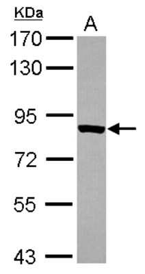 Western Blot: TARS Antibody [NBP2-20567]