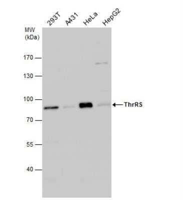 Western Blot: TARS Antibody [NBP2-20567]