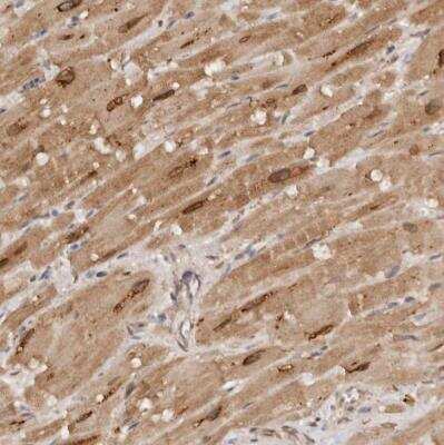 Immunohistochemistry-Paraffin: TARS2 Antibody [NBP1-82294]