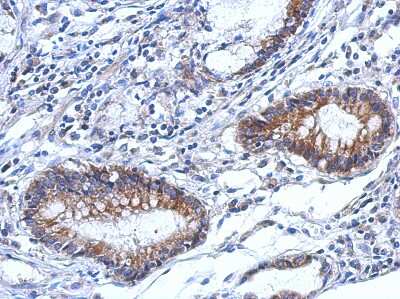 Immunohistochemistry-Paraffin: TARS2 Antibody [NBP2-20568]