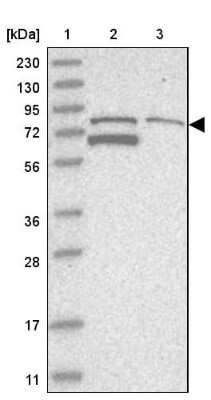 Western Blot: TARS2 Antibody [NBP1-82294]