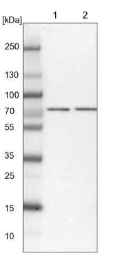 Western Blot: TARS2 Antibody [NBP1-82294]