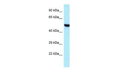 Western Blot: TARS2 Antibody [NBP2-88408]